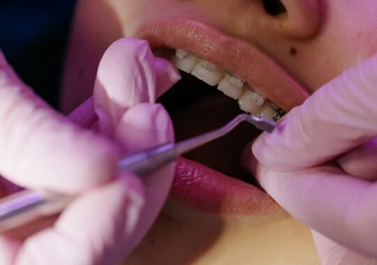 Essential Tips For Maintaining Your Braces And Oral Health