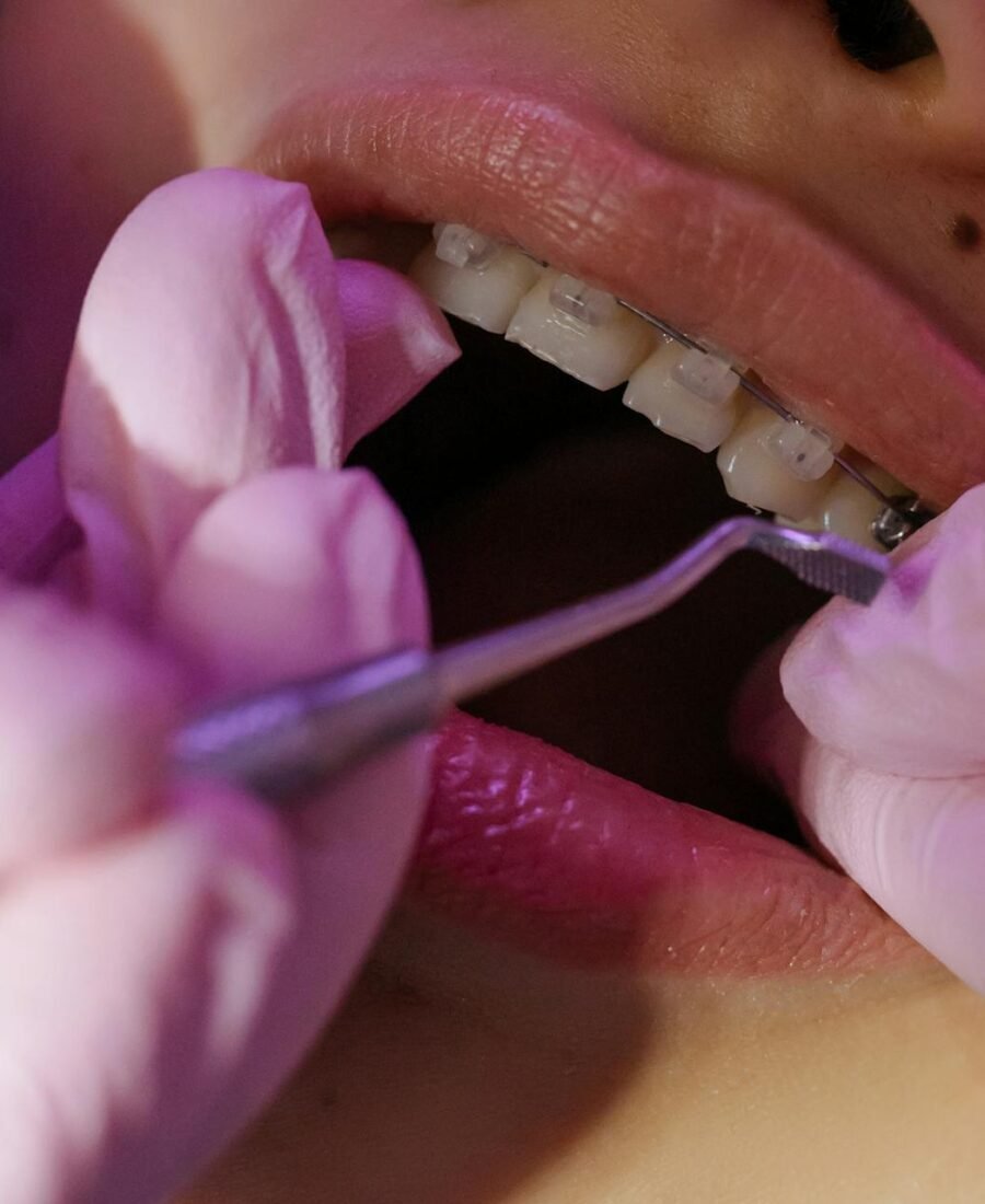 Essential Tips For Maintaining Your Braces And Oral Health