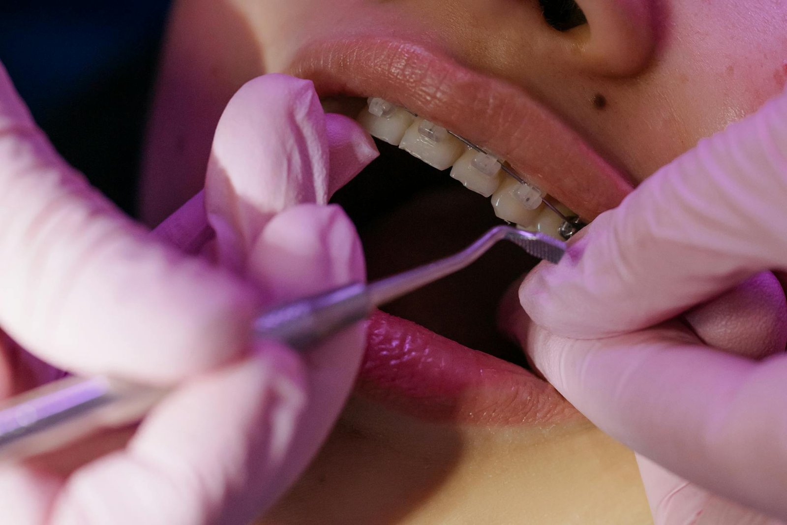 Essential Tips For Maintaining Your Braces And Oral Health